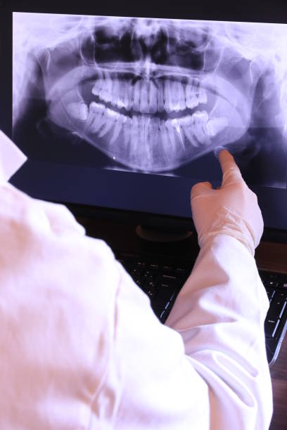 Best Emergency Root Canal Therapy in Waverly, IL